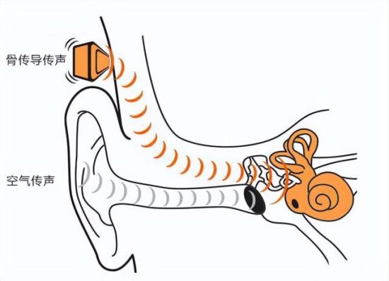 空气传导和骨传导<em>耳机</em>哪个好？这两种<em>耳机有什么区别</em>？