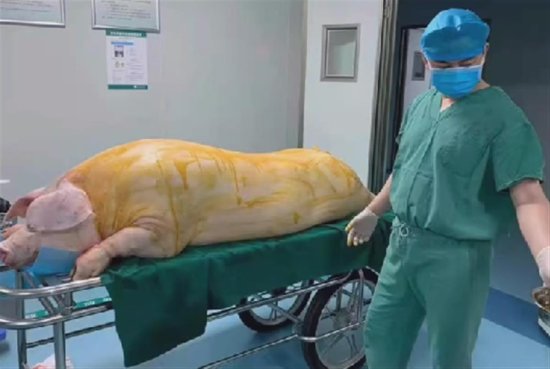 猪躺手术台被剥皮，医院：用于<em>皮肤</em>移植，有患者曾用6头猪