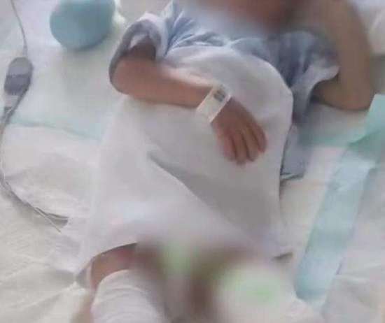 江苏男童被生母虐待致双腿截肢案开庭