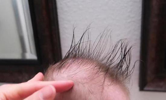 剃头改善宝宝发质，<em>没有科学依据</em>！头发是否浓密与4点有关