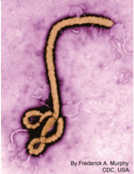 德堡“病毒暗史”：<em>埃博拉病毒</em>全球之旅及泄漏之虞带来的启示