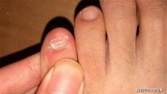为何有人说，小脚指甲不全的人，是纯种的<em>汉族</em>人呢？