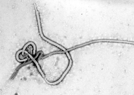 <em>埃博拉病毒</em>导致人体血管破裂？不，真正的原因是“细胞因子风暴...