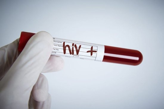 历史最低！澳洲新增艾滋病例仅552人！为什么却是坏事？