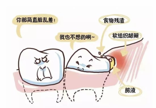 <em>牙齿痛</em>怎么办？找对病因是关键！