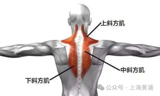 为什么10个<em>肩</em>颈痛患者，9个是“斜方肌”出问题？