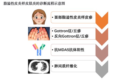 上海专家发现特殊类型皮肌炎——<em>脂溢性</em>皮炎样皮肌炎