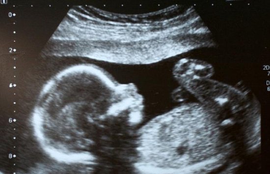 3个原因容易导致“胎停育”，孕妇在<em>怀孕前</em>这样做，胎儿更安全