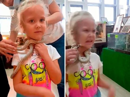 俄罗斯5岁女孩在<em>动物</em>园和蛇合影<em>被咬</em>脸 专家：它饿了