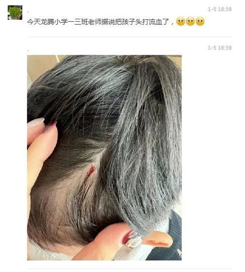 网传郑州一小学老师把孩子头打流血，学校深夜回应！